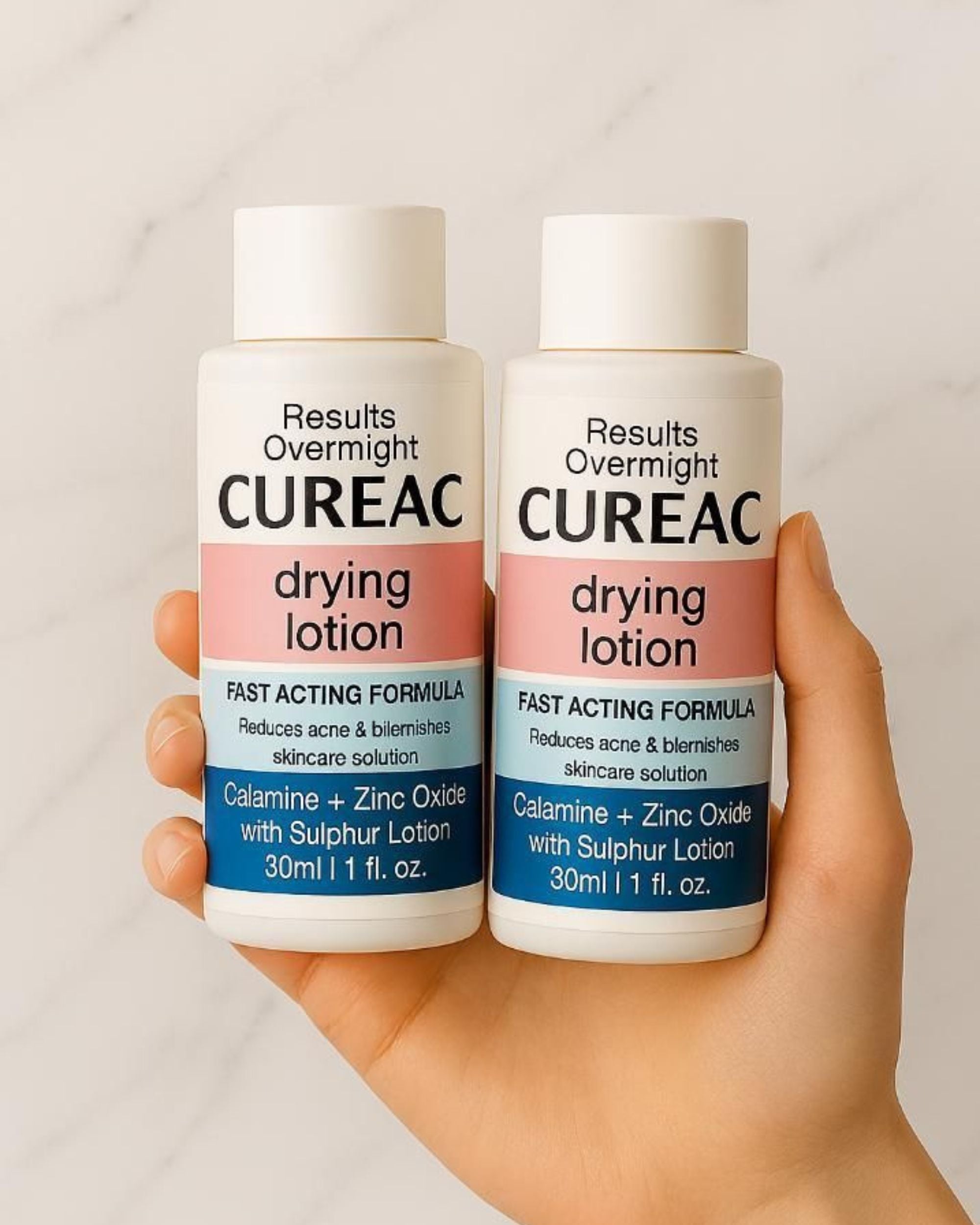 Drying Lotion With Calamine Zinc Sulphur Duo