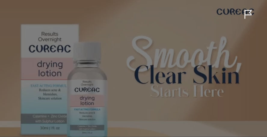 Drying Lotion With Calamine Zinc Sulphur Duo